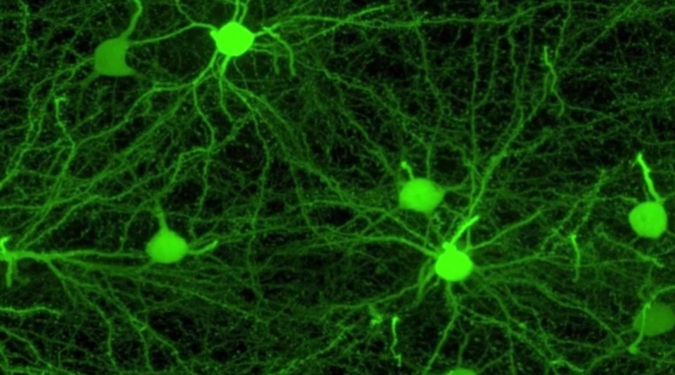 EncodingI's tweet image. The image shows a dense weave of neurons in the anterior cingulate cortex, which is the part of the brain involved in learning, memory, and some motor control.
bit.ly/3GIfLoG