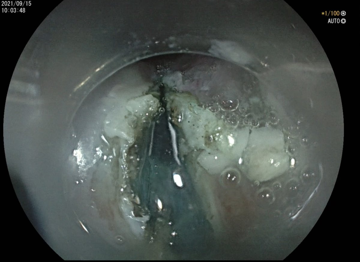 DIGESTIVE ENDOSCOPY tweet media