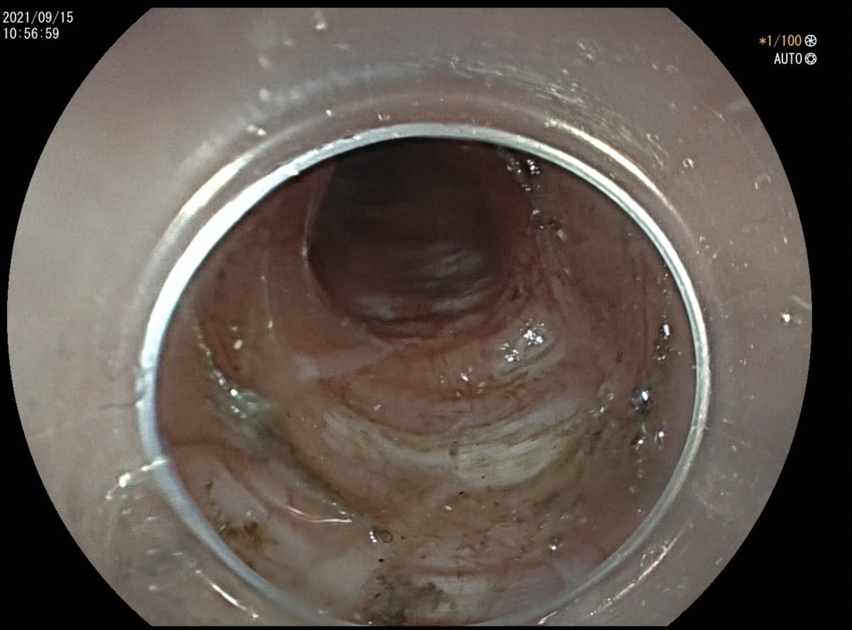 DIGESTIVE ENDOSCOPY tweet media