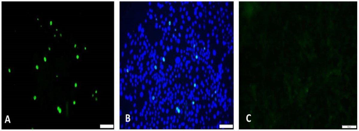 VirusesMDPI's tweet image. 🧐Porcine #circovirus type 2 (PCV2), the causative agent of a wasting #disease in weanling piglets, has periodically evolved into several new subtypes since its discovery, indicating that the efficacy of current #vaccines can be improved.

🔎mdpi.com/1999-4915/13/9…
