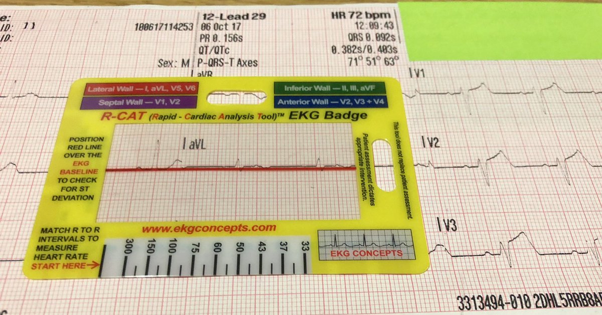 medicalaidememo's tweet photo. Back in stock: a perfect Christmas stocking filler? The #rcat ECG interpretation tools…..#ECG #ecgskills #meded #medtweet #paramedic #nurse #student #cardiac #clinical https://t.co/8ZUDmCxoET