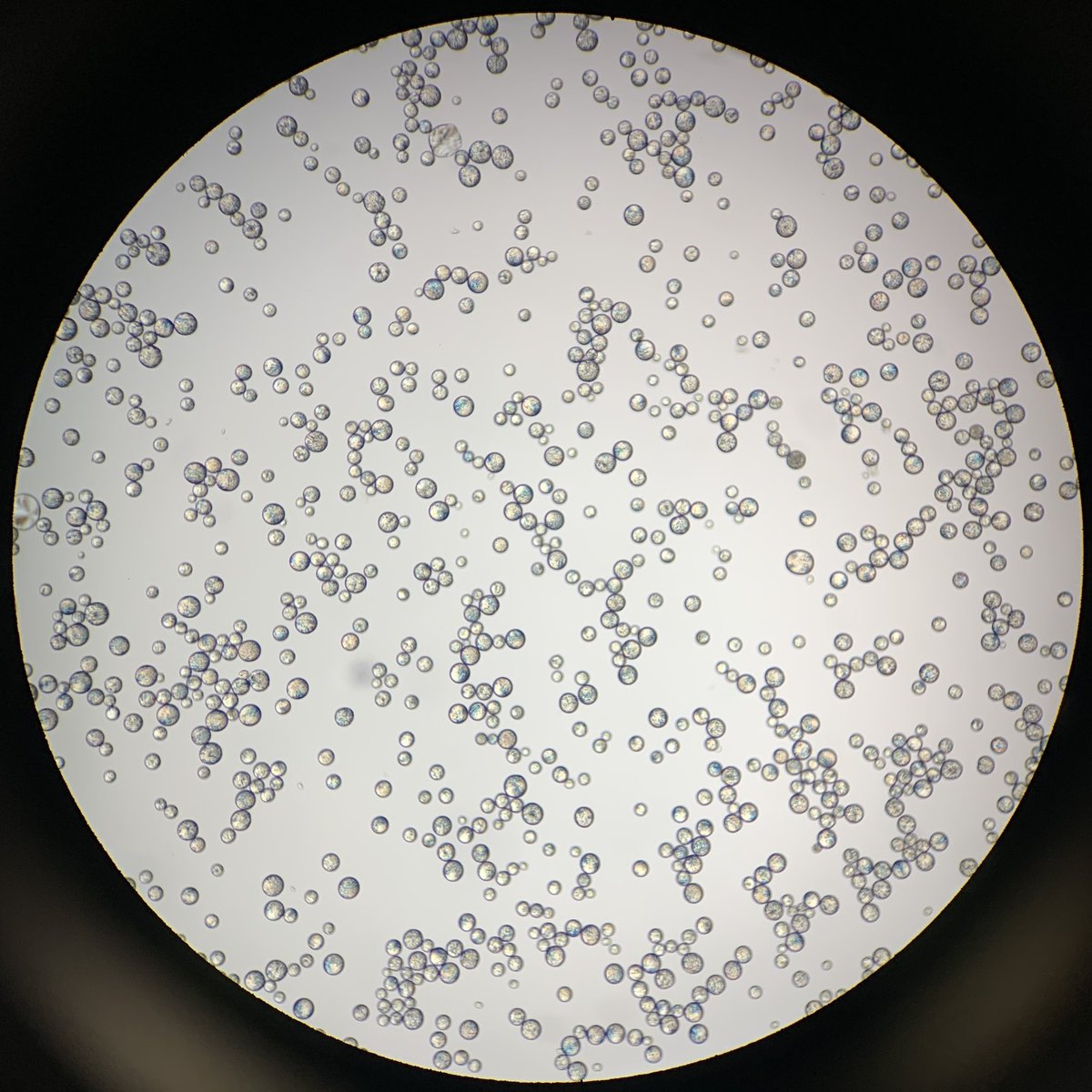 Spent the morning looking at my balls under a microscope #Mondays