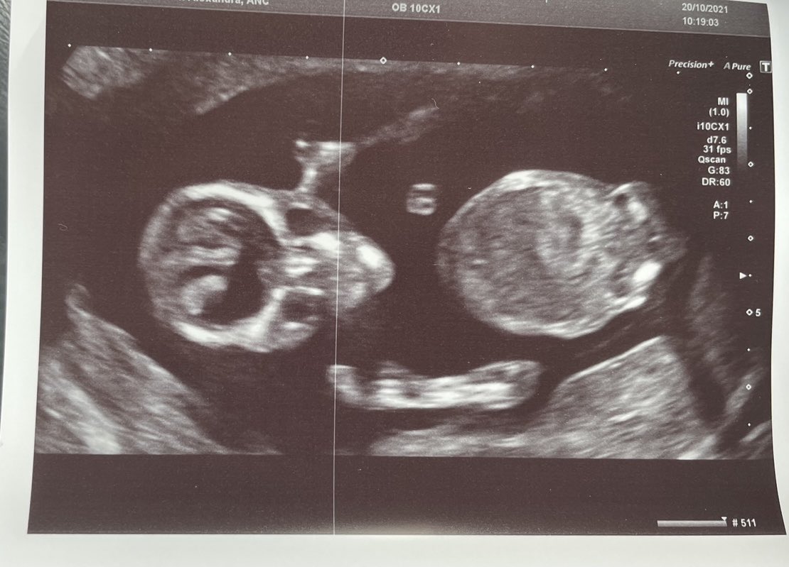 We’re a little late for Halloween but 💀Due Apr 2022 🥰