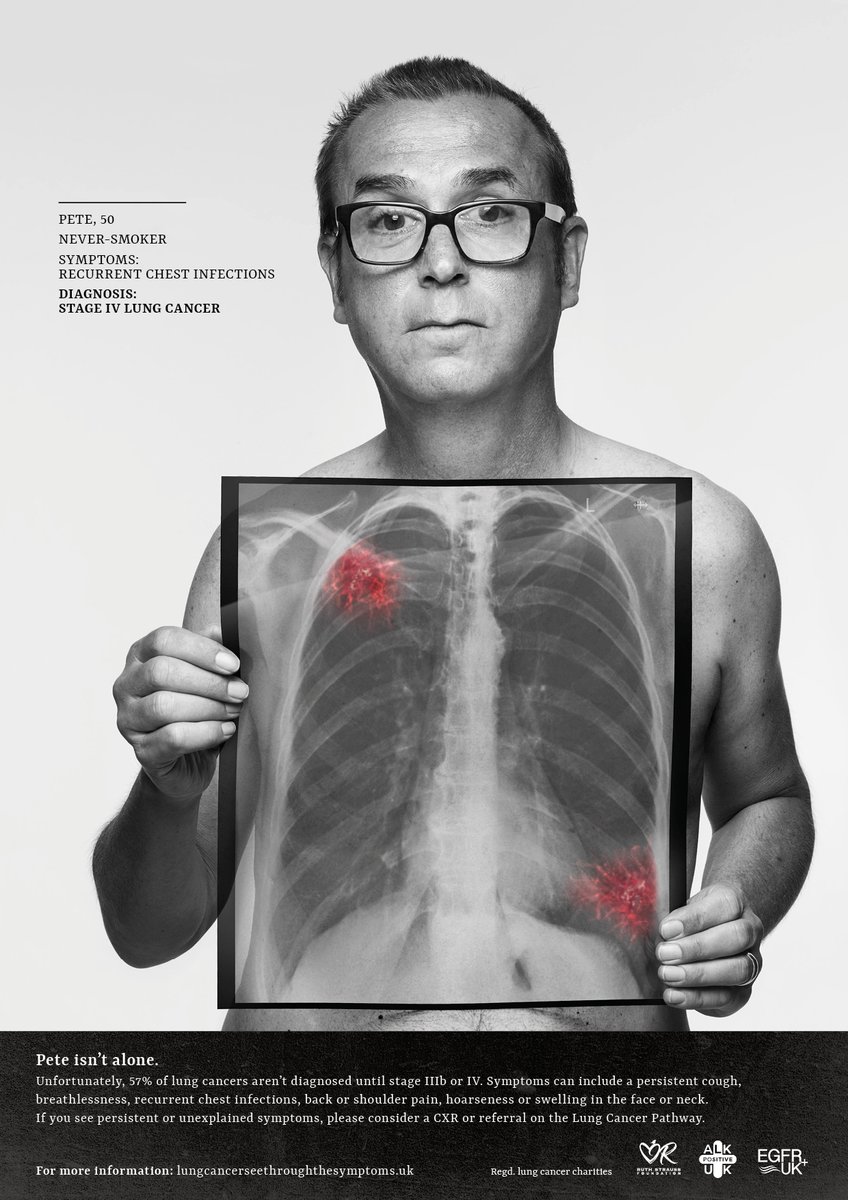 Today is the start of Lung Cancer Awareness Month. Early diagnosis saves lives. We urge anyone with persistent symptoms to seek medical advice; we urge clinicians to investigate symptoms regardless of age or smoking status. Anyone can get lung cancer. #seethroughsymptoms