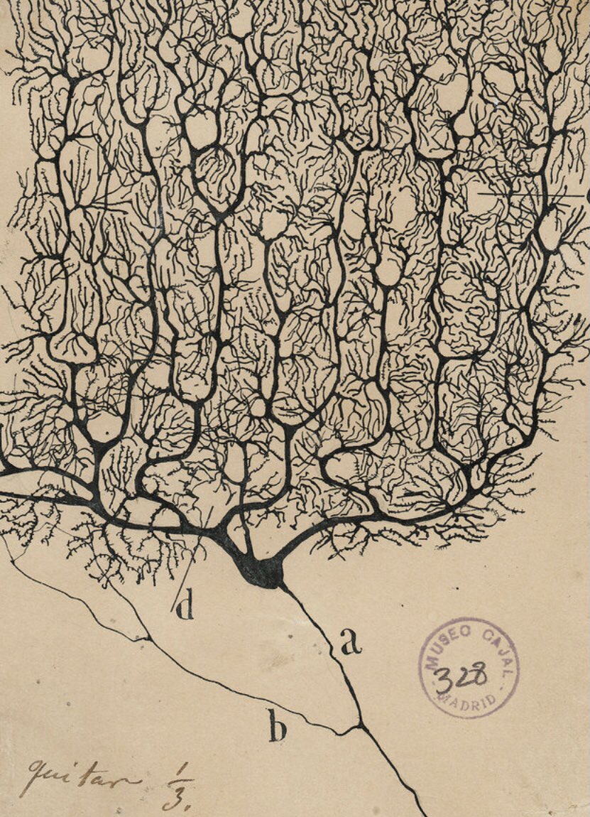 CentrodeNeur01's tweet photo. En el proceso de desarrollo cerebral, el fenómeno de “poda sináptica” es la eliminación de neuronas y sinapsis excesivas e innecesarias en la adolescencia, que ayuda a explicar en parte los cambios de comportamiento y anímicos, típicos de esta edad
#cerebro #MedicinaDelSueño https://t.co/wOIUWlrKSQ