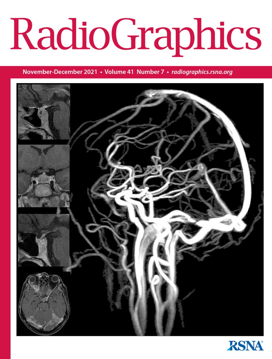 RadioGraphics's tweet photo. The latest issue of @RadioGraphics is now available! Check out the November/December issue here. https://t.co/EQlEfwE9yu #Radiology #RadCME #RadRes https://t.co/M1GP4GGnUB