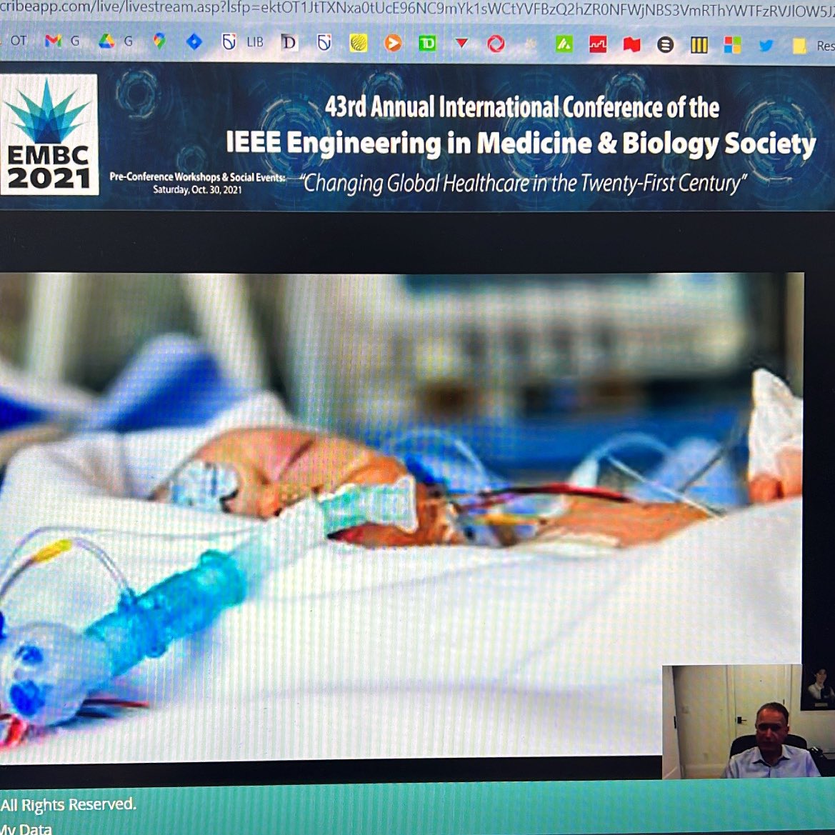 jehnister's tweet photo. @mch_childrens &amp; @OntarioTechHIR #ai4hw alum @DrEdwardPugh discussing how premature babies grow in an unnatural hostile environment (outside the womb) in the NICU @IEEELifeScience #IEEEembc2021 special session on engineering &amp; medicine in extreme environments https://t.co/K0MFN3nGvz