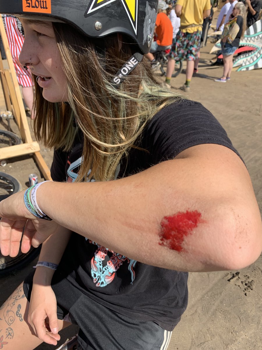 LilBMXWolf's tweet photo. Swampfest 2021 was everything I dreamed it would be! Bikes, blood, mud, mayhem! Super stoked I was able to make it!
#RockstarEnergyDrink
#SandMBikes #bmx #S1helmets #thespacebrace #OdysseyBmx #Etniesbmx #bikelife #slapfish #bmxgirl #bike #Liquiddeathwater #Swampfest #TigerBalm https://t.co/jliezlw9cv