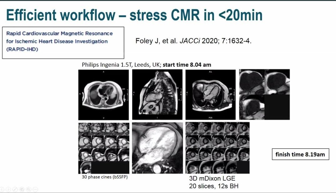 Who says stress #whyCMR is too long?
20 min exam!
👉 scmr.org/events/EventDe…

#SCMRAweSome #CPGuideline @danilorenzatti @PezelT @cshenoy3 @AKallifatidis @MarianaBLFalcao @SilCastelletti @chrisgraeni @PushpaShivaram @HEARTinMagnet @HeartDocSubha @MarcoGuglielmo