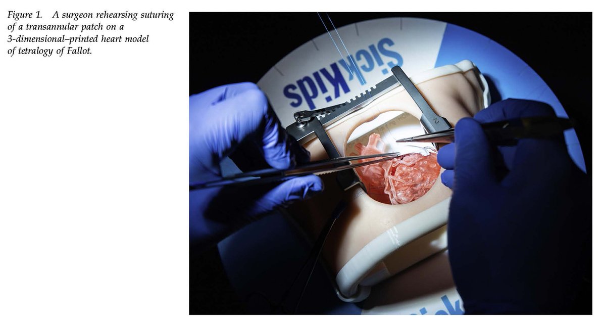 The Annals of Thoracic Surgery tweet media