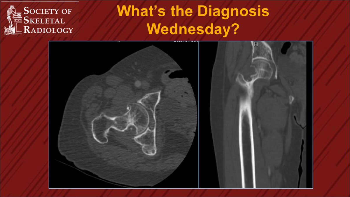 ssr_rwg's tweet photo. It’s What’s the Dx Wednesday!! Let us know what you think, stay tuned for the answer later, and have a great Wednesday!     #radres #futureradres #MSKRad 
@theAPDR @VivekKaliaMD @CQuirkMSK https://t.co/jlWFIJZKbv