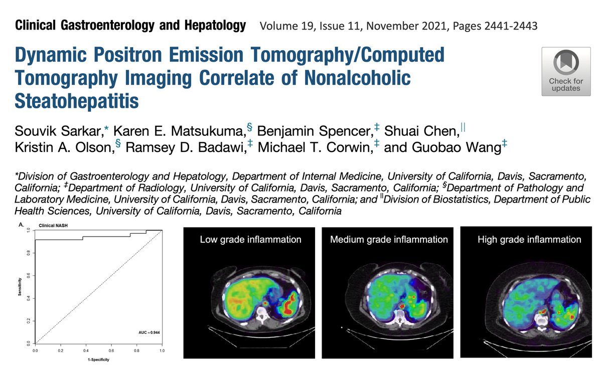 Our recent CGH paper by Souvik Sarkar et al reports the first results of parametric PET for measuring liver inflammation to diagnose NASH in fatty liver disease sciencedirect.com/science/articl… Close collaboration between colleagues from @UCD_IM, @UCDPath, @UCDavis_PHS, and @UCDRadiology