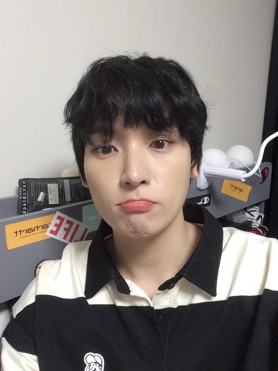 mykitten__'s tweet photo. 주근깨씨발 https://t.co/Lm88mPFYRC