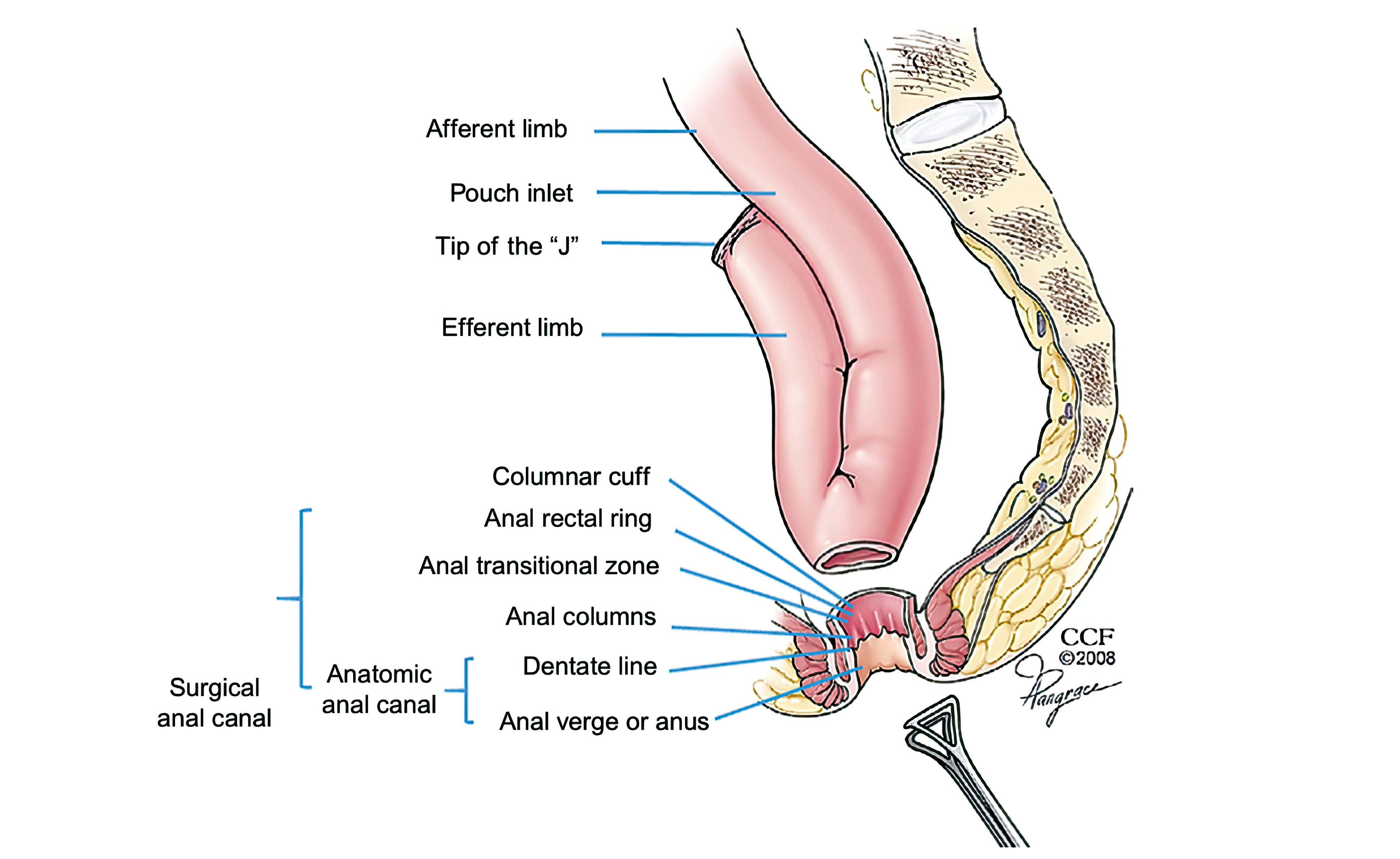 Keith Siau on X: Anatomy of a pouch 📍 #4KMedEd #GITwitter https