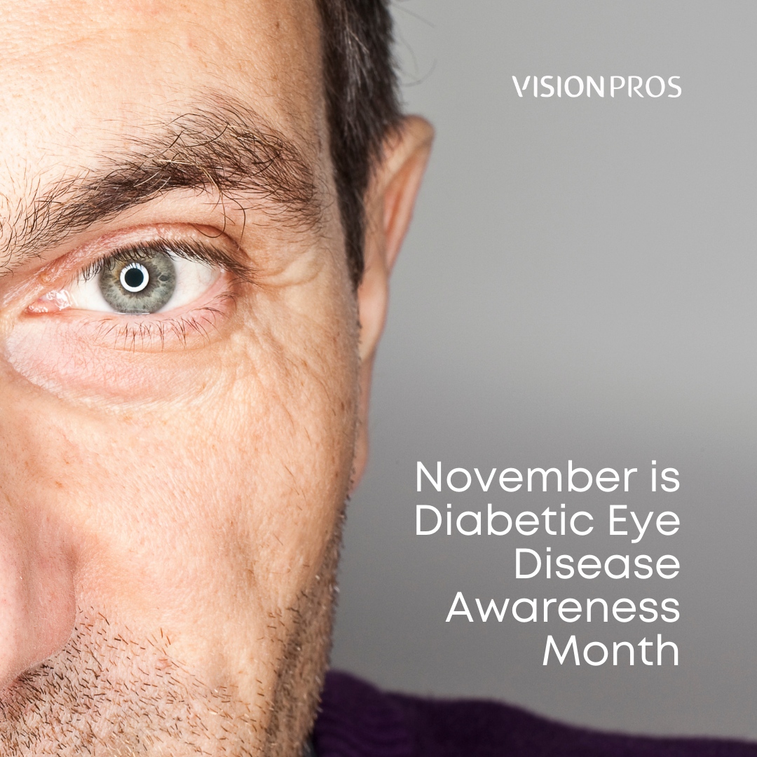VisionPros's tweet photo. Diabetic eye disease, a leading cause of blindness, often has no early warning signs. Early detection, timely treatment, and appropriate follow-up care are the only ways to prevent visionโฏ loss
#visionpros #loveyoureyes #contactlenses #ophthalmology #optometry #healthyeyes https://t.co/6NDYoTt6SL