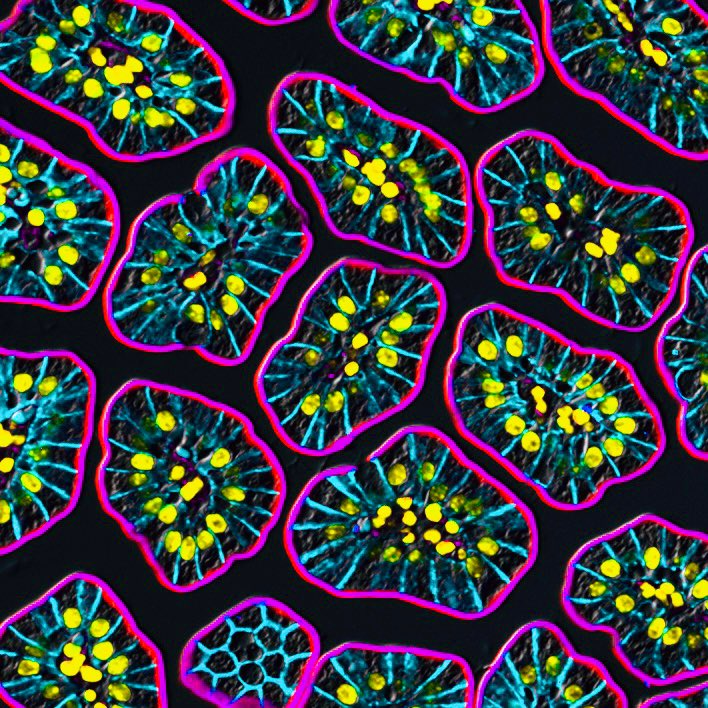 Happy #MicroscopyMonday! Intestinal villi stained for e-cadherin in in blue, NHE3 in red and gamma actin in magenta/purple. Nuclei are yellow. #microscopy #bioart #sciart