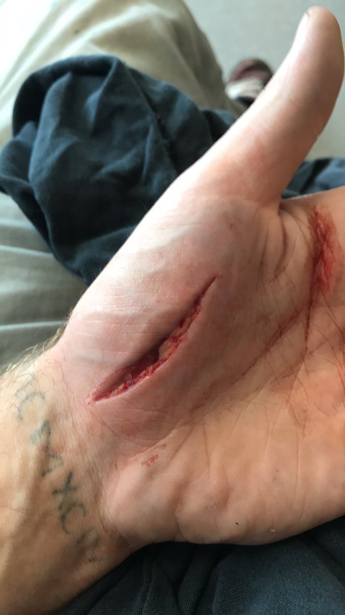 902damon's tweet photo. I’m about to go full Karen mode in here, mfs here for an hour and getting checked for minor injuries, I’ve been here for 10 hours waiting for stitches…what the actual fuck is going on??? https://t.co/Y50kI2hLNj