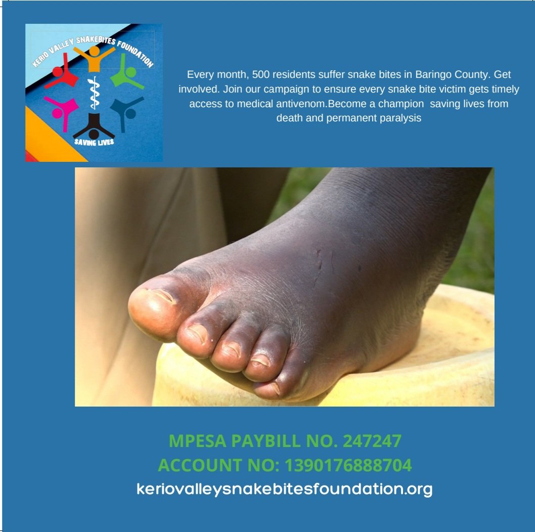 KerioSnakebites's tweet photo. Victims of snake bites in Kerio Valley, as a result of failure to receive emergency medical antivenom within an hour of snake bites (THE GOLDEN HOUR), end up dead, or suffer morbidity/lifetime paralysis. You can help us fight this trend.

#savinglives #snakebites #ntds https://t.co/TnA3YgtKJo