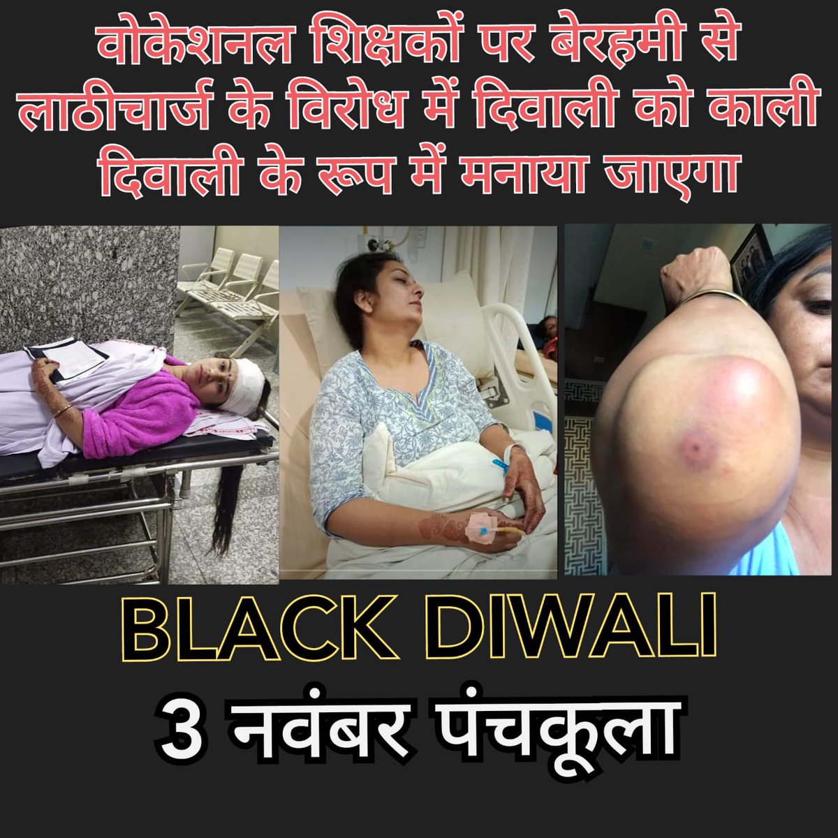 AmitCho86493162's tweet photo. निहत्थे शिक्षकों पर लाठियों की बौछार
करती हैं खट्टर सरकार
@mlkhattar @cmohry @BJP4Haryana @chkanwarpal @dpradhanbjp @PMOIndia
#VTAHaryana 
#BLACK_DIWALI_AGAINST_LATHICHARGE
#मनोहर_सरकार_वोकेशनल_टीचर्स_का_वादा_पूरा_करो https://t.co/QnzbaPBC4j