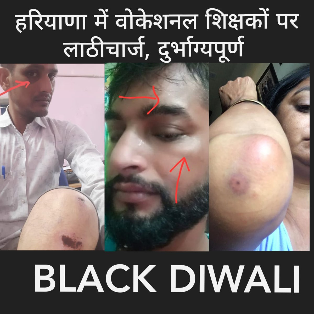 Ajaymevliwal's tweet photo. नहीं हटेंगे, नहीं डरेंगे, नहीं थमेंगे
ये शिक्षक है किसी के रोकने से नहीं रुकेंगे
@mlkhattar @cmohry @BJP4Haryana @chkanwarpal @dpradhanbjp @PMOIndia
#VTAHaryana 
#BLACK_DIWALI_AGAINST_LATHICHARGE
#मनोहर_सरकार_वोकेशनल_टीचर्स_का_वादा_पूरा_करो https://t.co/p73kCU3yc1