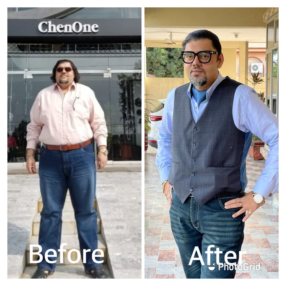 abdalian4ever's tweet photo. My weight loss journey of 22 months.
Weight 152 to 92kgs-60 kgs
Waist 52 to 38 in- 14 in
BMI 46.9 to 27.8
co-morbidities: Diabetes, sleep apnoea,hypertension &amp; cholesterol CURED.
5 kgs to reach my target destination.
Contact for weight loss surgery
Dr Maaz ul Hassan +923211467063 https://t.co/staeRduU66