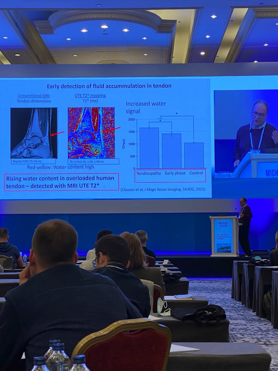 #IOCATPC21
Early tendinopathy seems to be related to tendon swelling- water accumulation and changes between fascicles. Not partial tears
Kjaer