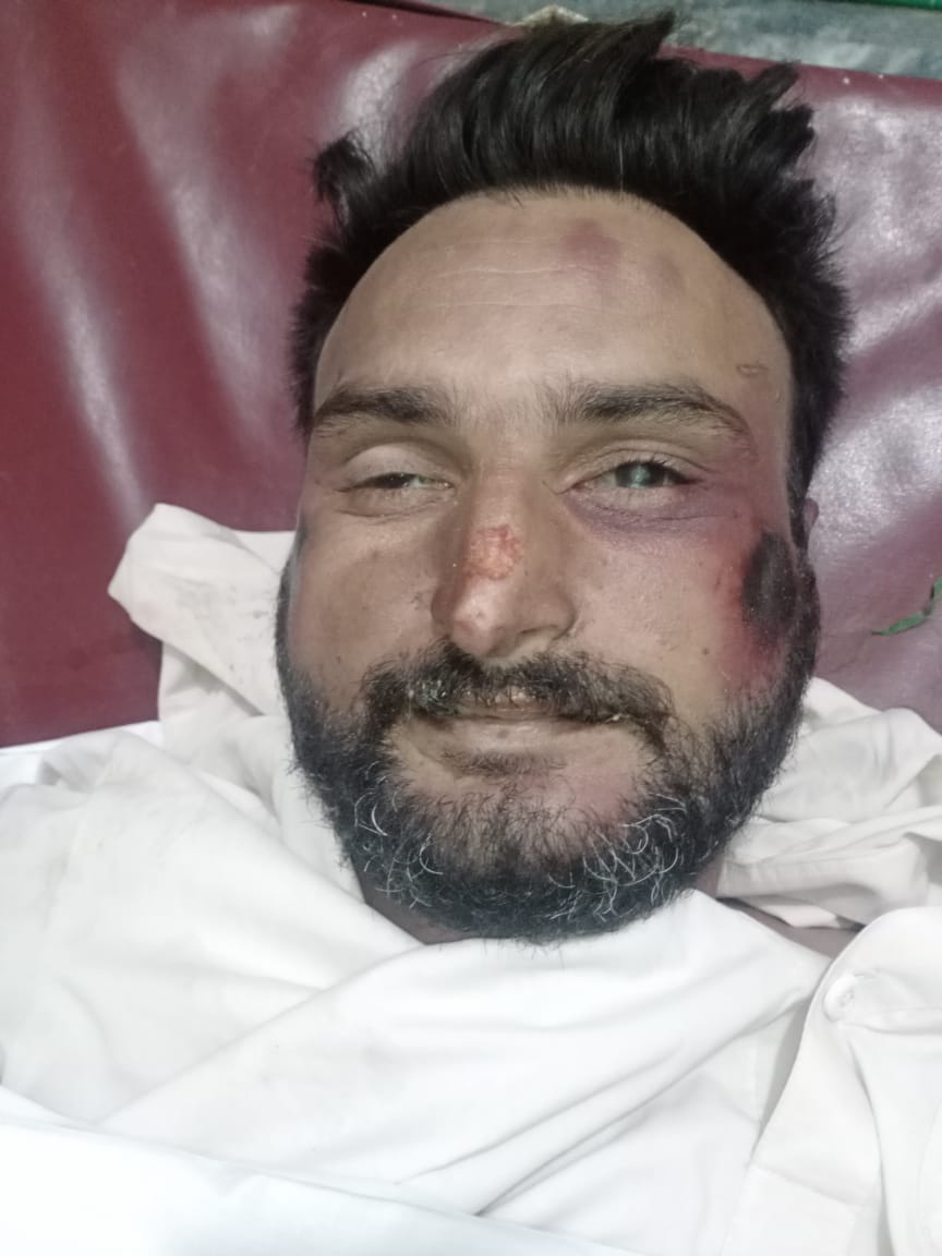 Constable Adnan Butt of Gujranwala police was abducted by TLP goons in Wazirabad during protests. He was bludgeoned & pulped to death. His brutally tortured dead body dumped in the nearby fields was found last night. Adnan leaves behind a widow & a six-year-old daughter.