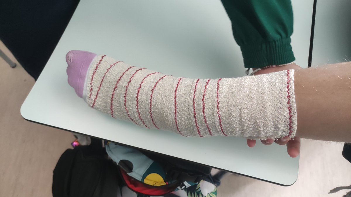 Aprendemos un tipo de vendaje de tobillo con el proyecto de sexto. danielcoggins.wixsite.com/salud-y-natura… <a href="/HBSTORREJON/">Humanitas Torrejón</a>