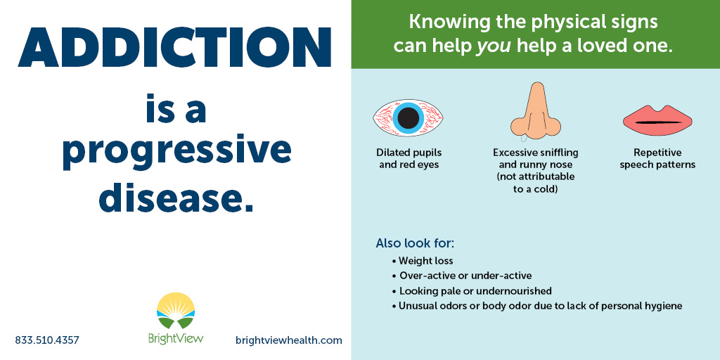 BrightViewHlth's tweet photo. Accurately identifying substance use disorder is essential to a successful recovery journey. Call us at 844-710-8900 to learn more about BrightView's quality, accessible treatment today.

#addictionhelp #addictionrecovery #sober #drugaddiction #recoveryispossible #drughelp https://t.co/jxFpyqpODD