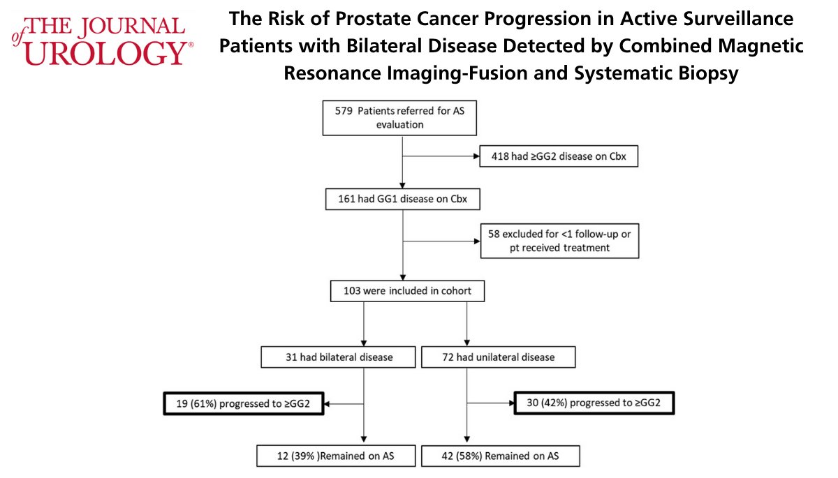 Journal of Urology (@jurology) on Twitter photo Bilateral disease and higher PSA Density at confirmatory combined biopsy conferred greater risk of earlier active surveillance progression
Read the full text here: bit.ly/3jXYT3L <a href="/PeterPintoMD/">Peter Pinto</a> Bilateral disease and higher PSA Density at confirmatory combined biopsy conferred greater risk of earlier active surveillance progression
Read the full text here: bit.ly/3jXYT3L <a href="/PeterPintoMD/">Peter Pinto</a>