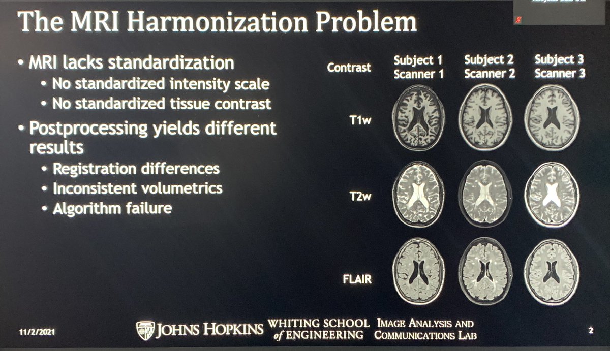 AVenkatesanMD's tweet photo. Thank you to Dr. Jerry Prince from  @JohnsHopkins for his excellent talk on MRI harmonization at the @GCC_TI Translational Imaging Conference on Future Trends in Quantitative and Theranostic Imaging. #TranslationalImaging #RadTwitter #TI21 https://t.co/Sl2sC0zarQ