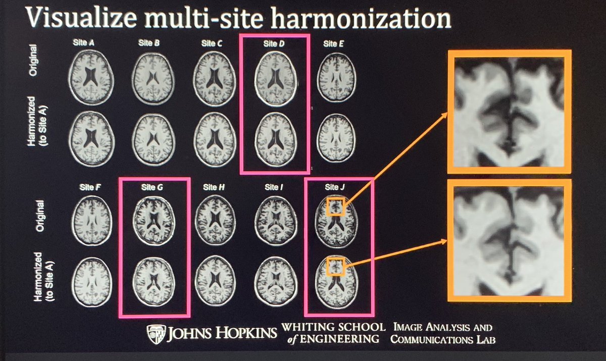 AVenkatesanMD's tweet photo. Thank you to Dr. Jerry Prince from  @JohnsHopkins for his excellent talk on MRI harmonization at the @GCC_TI Translational Imaging Conference on Future Trends in Quantitative and Theranostic Imaging. #TranslationalImaging #RadTwitter #TI21 https://t.co/Sl2sC0zarQ