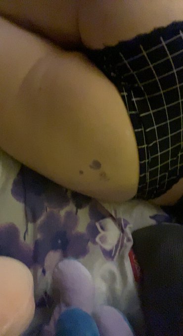 #bruised #ass https://t.co/JQzQmxaNgx<a href="/tag/bruised"class="tags">#bruised</a><a href="/tag/ass"class="tags">#ass</a>