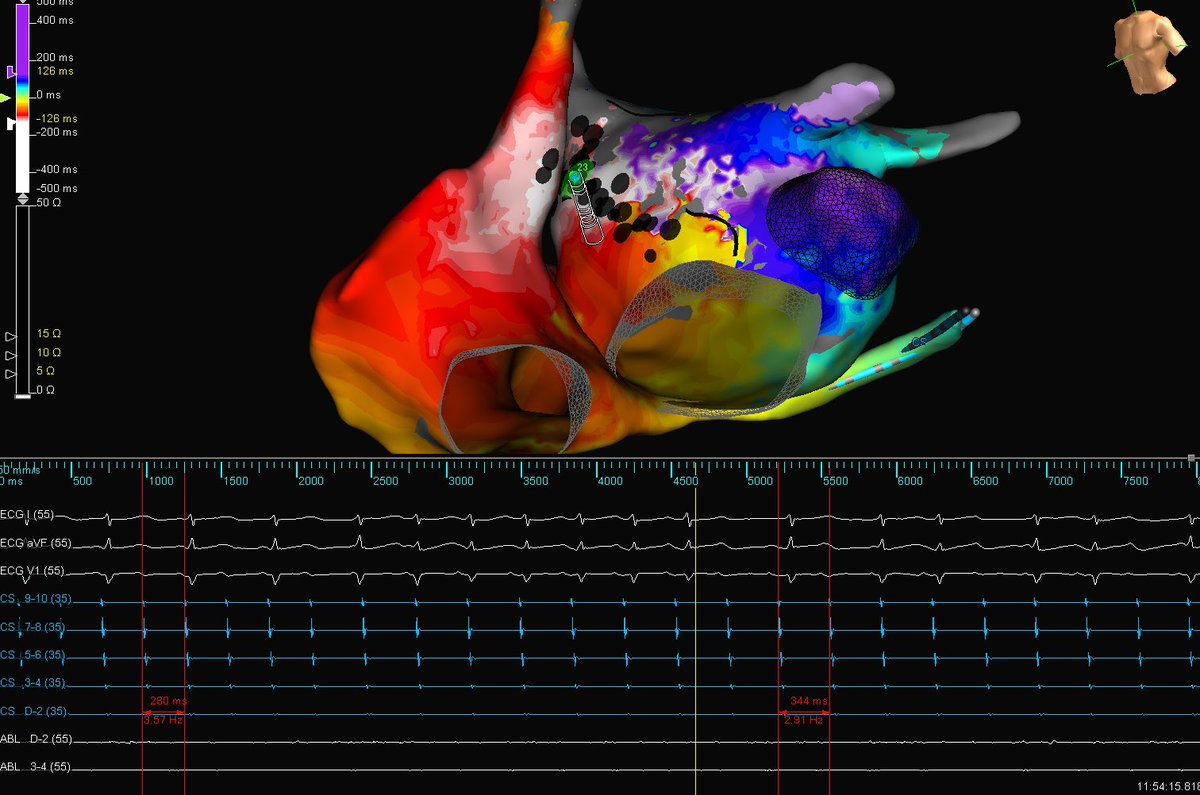 Mackenzie Willborn tweet media