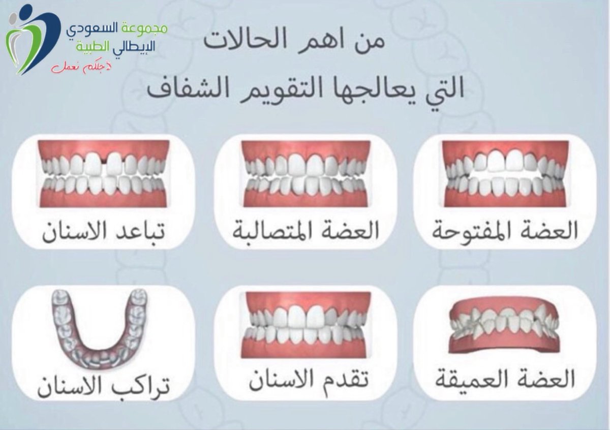 simgroup_sa's tweet photo. أهم الحالات التي يعالجها التقويم الشفاف . 

#تقويم_الاسنان #الاسنان #انفزلاين #تقويم_شفاف #invsalign #braces #صحتك #النعيريه #مليجه #الصرار #قريه_العليا #الجبيل #الخفجي #صحه_الاسنان #حفر_الباطن #الكويت 
@simgroup_sa #لأجلكم_نعمل https://t.co/Otl17x2rXK