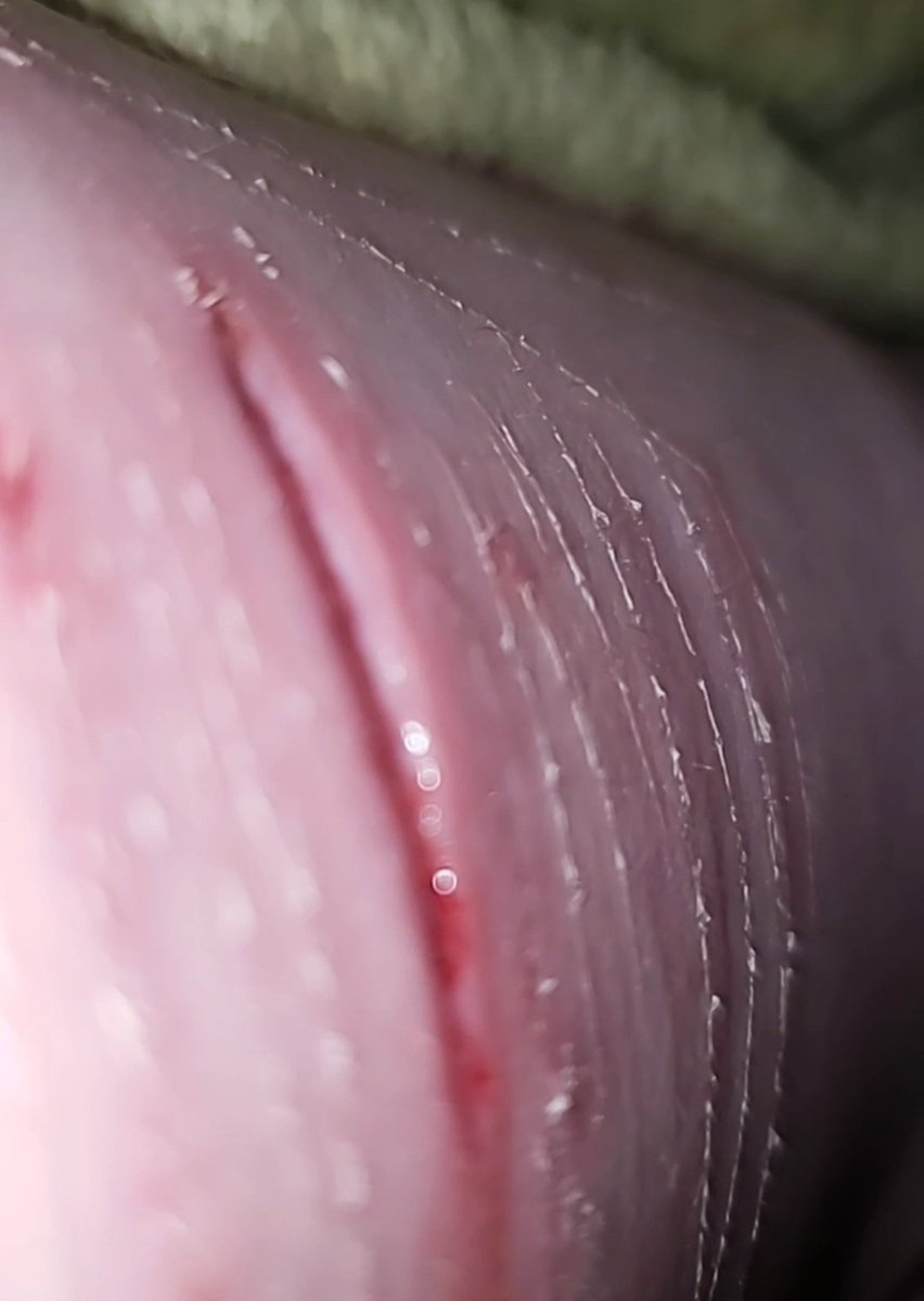 Shitnpee's tweet photo. Ripped open again this mf the most annoying shit ever https://t.co/AYyCqjAI1y
