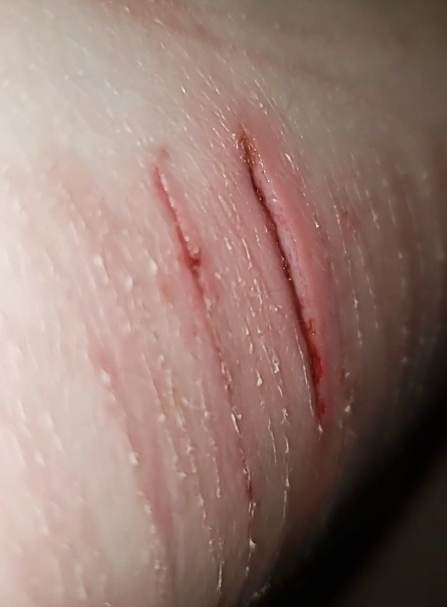 Shitnpee's tweet photo. Ripped open again this mf the most annoying shit ever https://t.co/AYyCqjAI1y