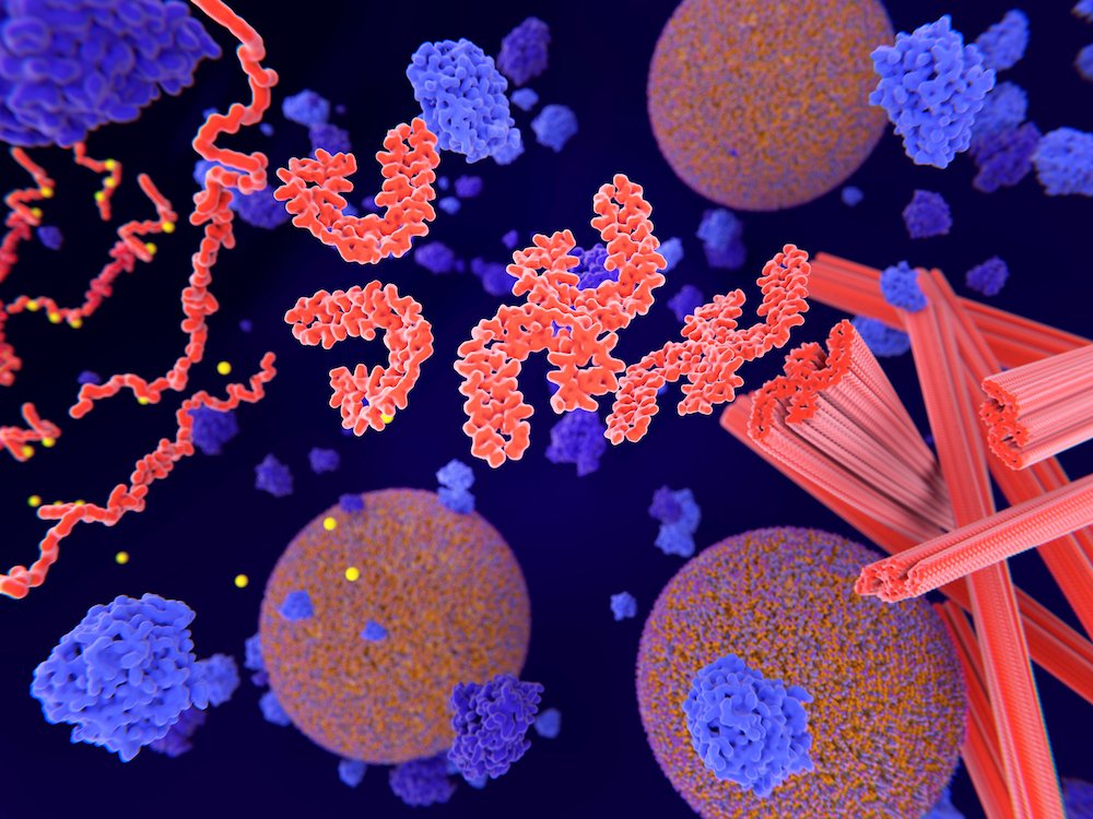 UK Dementia Research Institute (@ukdri) on Twitter photo Superb new tau study out last week from <a href="/KlenermanLab/">KlenermanLab</a> (UK DRI at Cambridge) that advances our understanding of Alzheimer's disease progression - important for future treatment opportunities
Read the full story👉 bit.ly/3q3WsAq Superb new tau study out last week from <a href="/KlenermanLab/">KlenermanLab</a> (UK DRI at Cambridge) that advances our understanding of Alzheimer's disease progression - important for future treatment opportunities
Read the full story👉 bit.ly/3q3WsAq