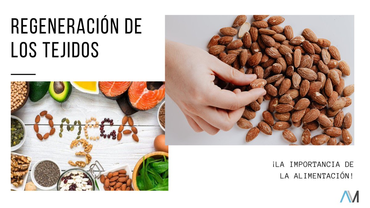 drmarquesrapela's tweet photo. Una correcta alimentación es clave cuando nuestros tejidos se están recuperando de una cirugía. Además nos ayuda a mejorar nuestro sistema inmune.
Los #nutrientes son importantes pero proteínas, aminoácidos y grasas saludables como el omega 3 son fundamentales.
#dralbertomarques https://t.co/tZNsKpVfno