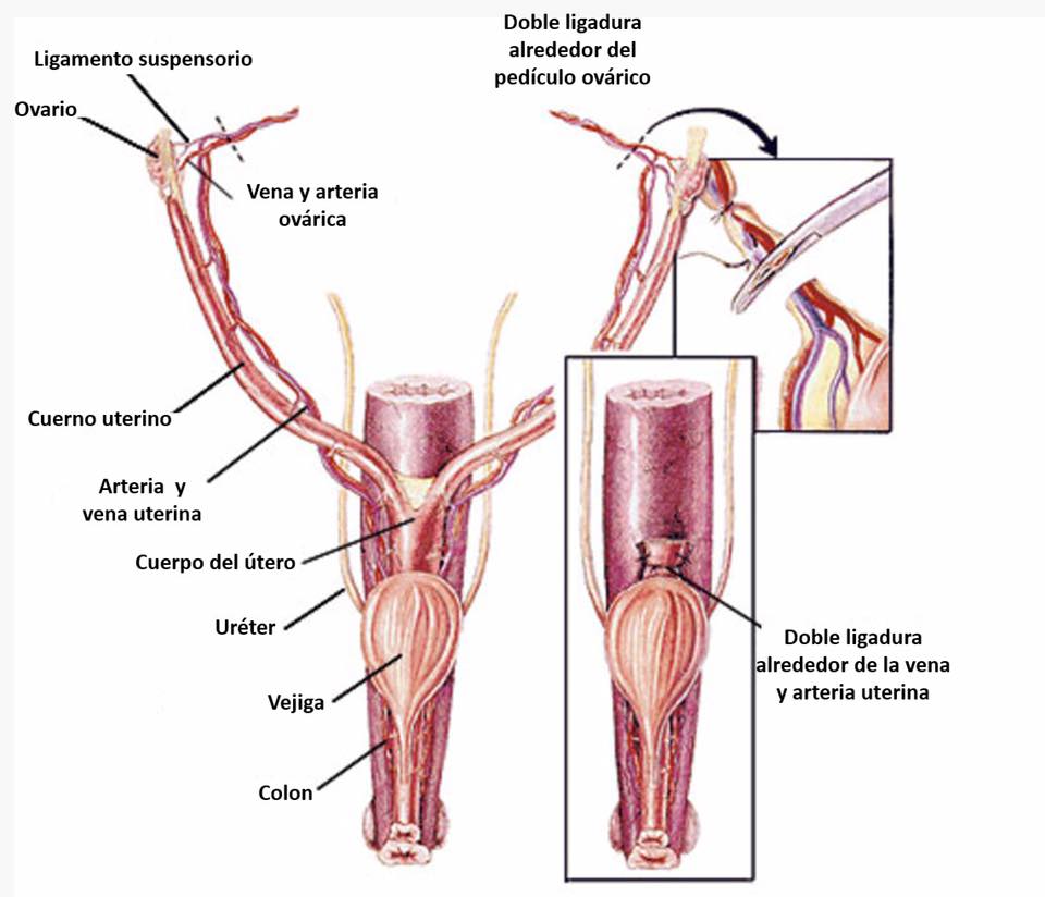 𝗢𝗩𝗔𝗥𝗜𝗢𝗛𝗜𝗦𝗧𝗘𝗥𝗘𝗖𝗧𝗢𝗠𝗜𝗔 #veterinario #medicina #Animales  #mascotas https://t.co/FoBvqUv5Ip https://t.co/bPOpNfdDIR, image size:960x824