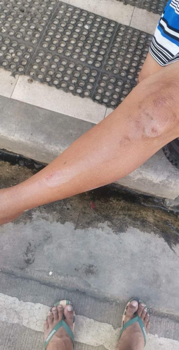 ABCarlosTayag_'s tweet photo. ALERT! 

Kaninang alas-9 ng umaga ay nanguha ang Hawkers ng mga paninda at kagamitan tulad ng mga lamesa at payong sa mga manininda ng Trabajo Market. Nakitang nasugatan rin si Nanay Evelyn pagkat nagkahilahan ng mga gamit.

#DefendTrabajoMarket
#StandWithTrabajoMarketVendors https://t.co/qWm1QYtC5r