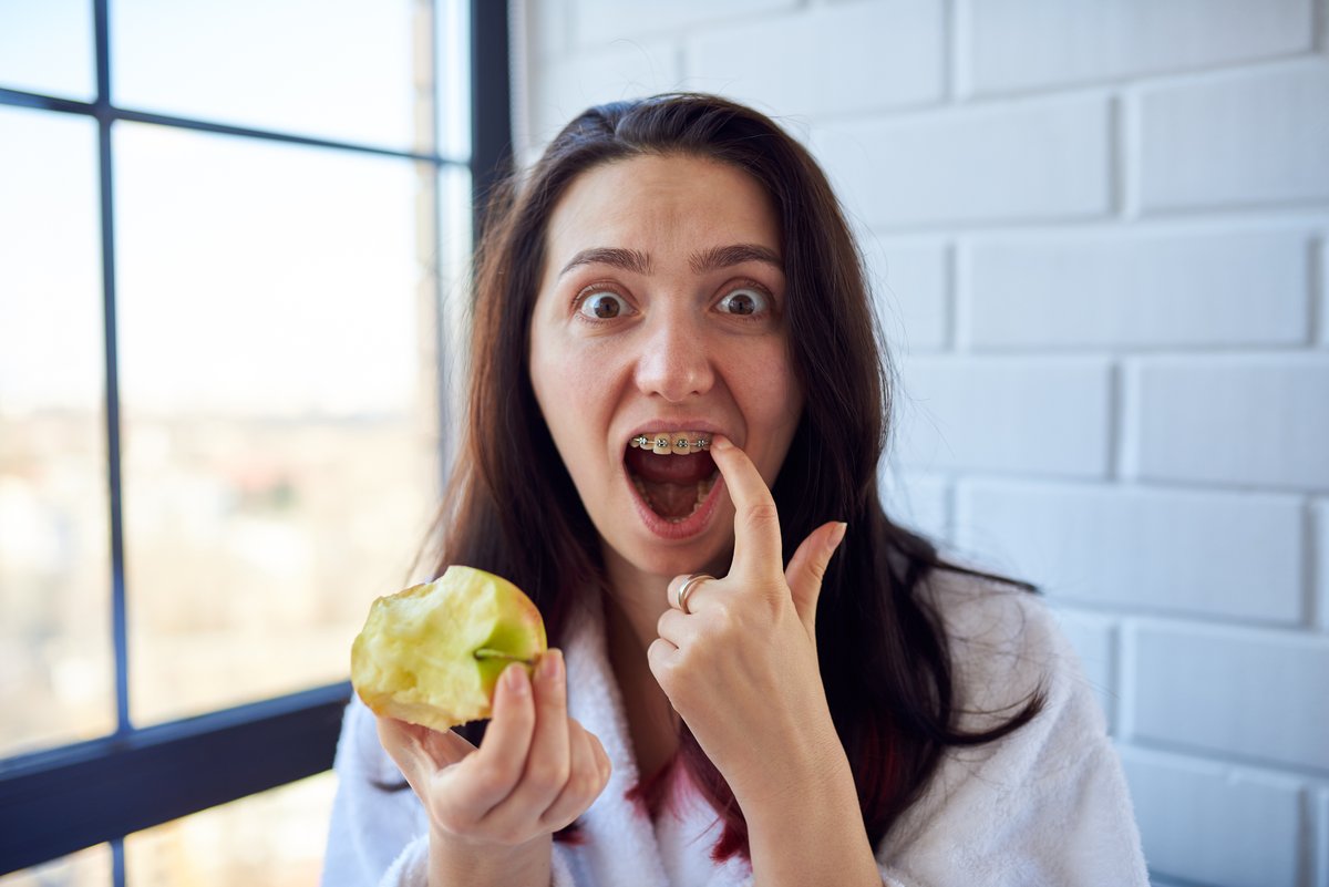 When it comes to traditional braces, there are certain foods you should avoid (whole apples, hard candy, popcorn, etc.) due to potential breakage of the orthodontic appliances. If that's a deal breaker for you, Invisalign may be for you! ow.ly/Ls9U50GEMN8