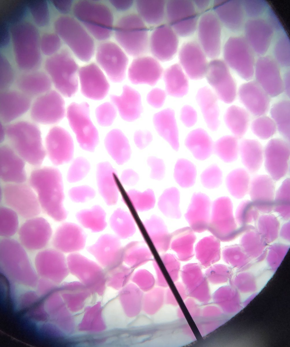 STMsrichards's tweet image. Onion cell osmosis!!!   The students were fascinated with this lab !  Cells shrink in hypertonic solutions but swell in hypotonic solutions.  It was a hit!!   #microscopelab #osmosis #ilovebiology @stmsaints