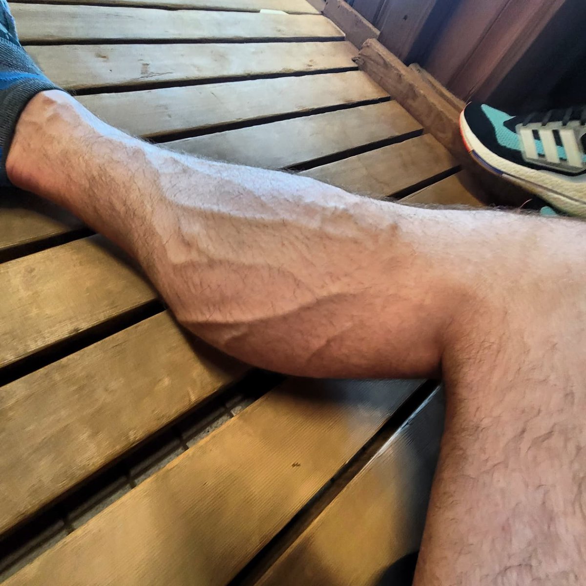 TommyCalves tweet picture