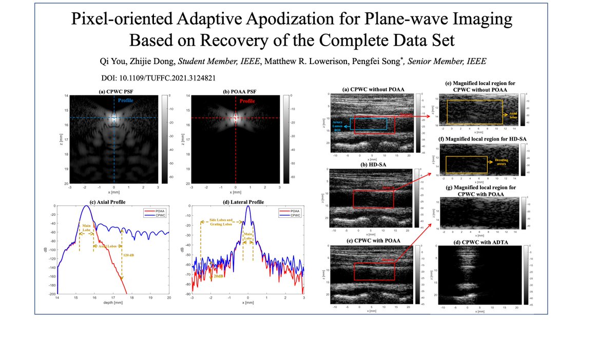 Check out our latest publication in IEEE TUFFC! We designed a pixel oriented adaptive apodization to improve coherent plane-wave compounding. This technique has great potential for a multiple of imaging modalities based on #UltrafastUltrasound imaging. doi.org/10.1109/TUFFC.…