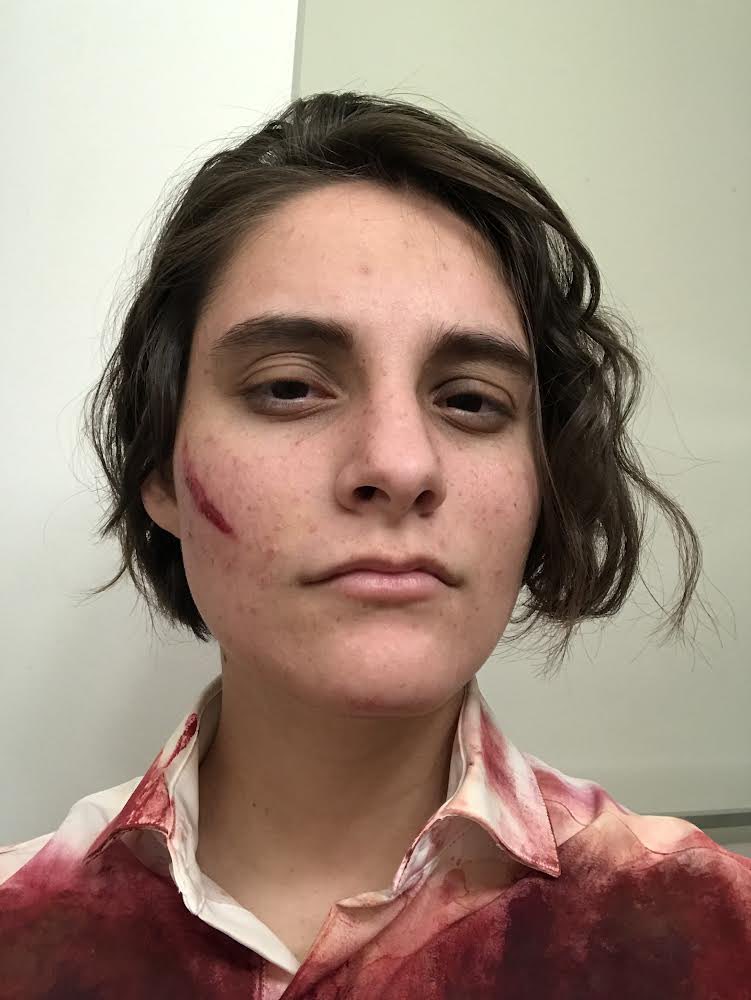 minormends's tweet image. I’M A LITTLE LATE BUT HAPPY HALLOWEEN! 
here’s my will graham! my makeup is a bit messy, i’ve never done any kind of makeup before. but i had SO MUCH fun with this!!! @BryanFuller #Fannibal #FannibalFamily #WillGraham #Hannibal #HannibalTV #NBCHannibal #Halloween #Halloween2021