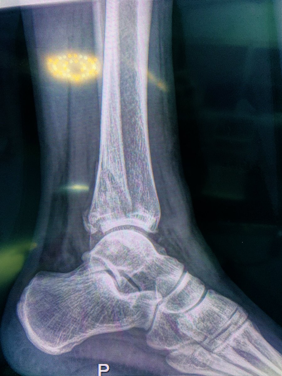 drbitcoin12's tweet photo. Otra vida que tocamos  y bendecimos ; tu como medico a cuanto ser humano has ayudado ? … R4TYO 🙏🏼 #notodoesbussine https://t.co/lxKRAihyuc