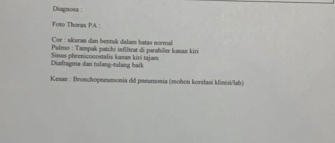 Masih belum ada perubahan dari sejak rontgen terakhir 3 bulan lalu.

#LongCovid19