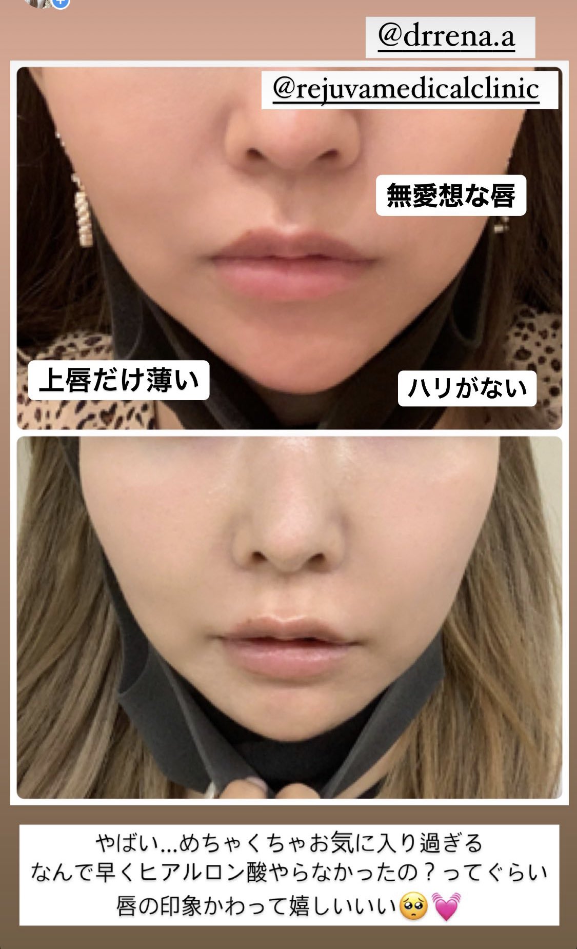 パパ活ol Dt中 8 Ig32 Twitter