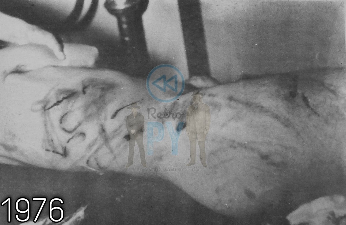 ReloadedRetropy's tweet image. Para los que siguen festejando el cumple de tembelo, acá les dejamos una muestra de uno los crímenes más aberrantes de la dictadura. Así quedó el cuerpo de Joelito Filartiga de tan solo 17 años luego de ser torturado por la policía el 30 de marzo de 1976...